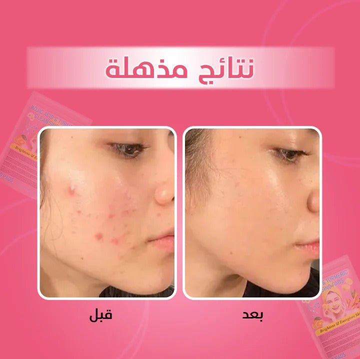 TURMERIC & KOJIC ACID PADS