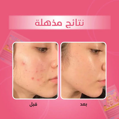 TURMERIC & KOJIC ACID PADS